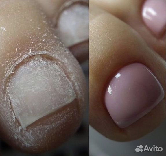 Педикюр с покрытием