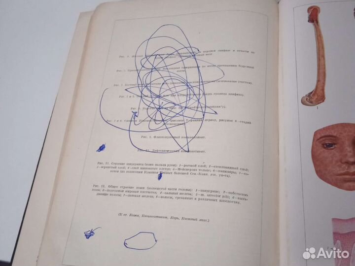 Большая медицинская энциклопедия