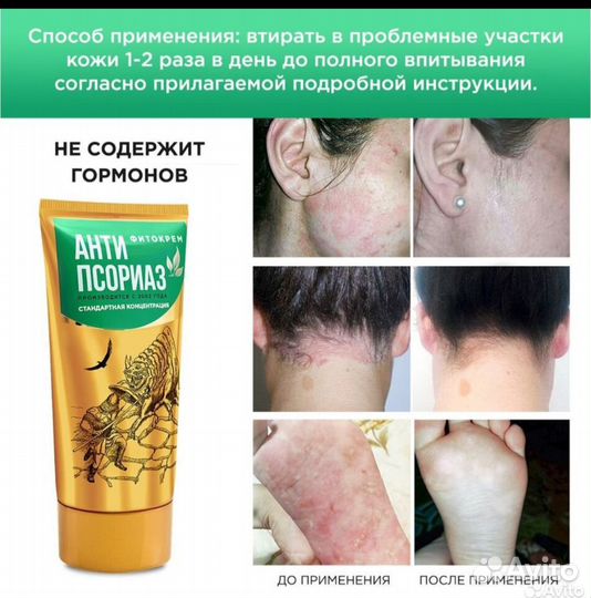 Фитокрем Антипсориаз