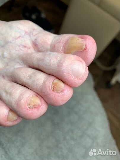 Услуги подолога