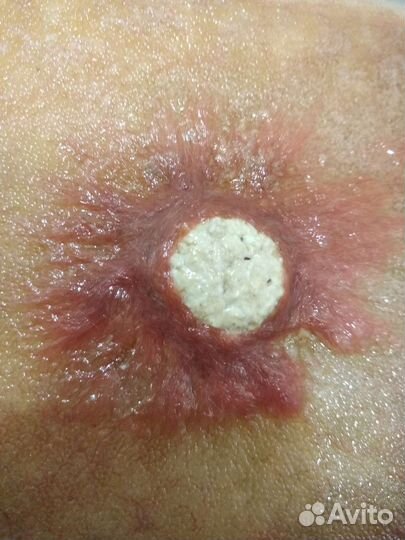 Живой корм для рыбок