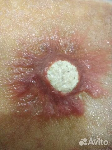 Живой корм для рыбок