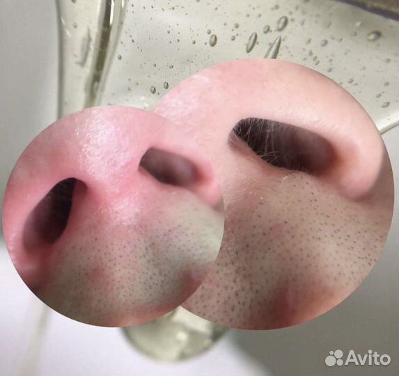 Восковая/сахарная депиляция/эпиляция/шугаринг