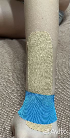 Тейпирование