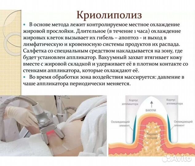 Криолиполиз