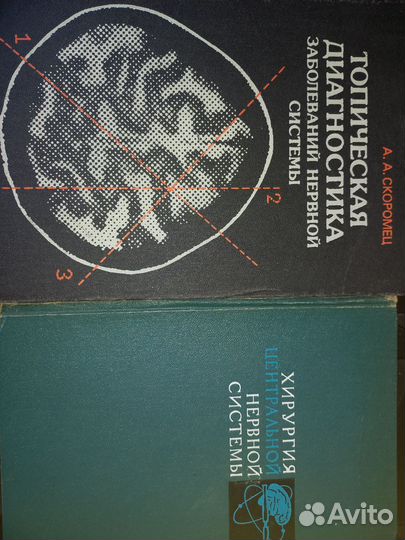 Книги студенту, нейрохирургия, неврология