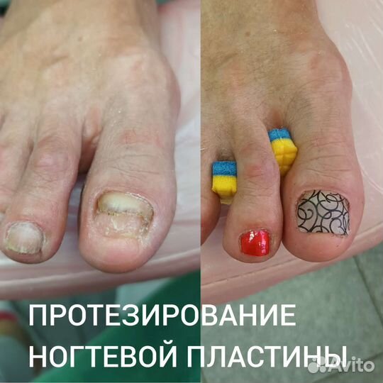 Подолог. Педикюр. Маникюр