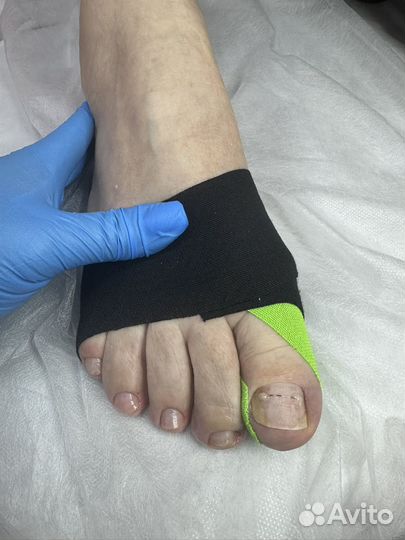 Услуги подолога