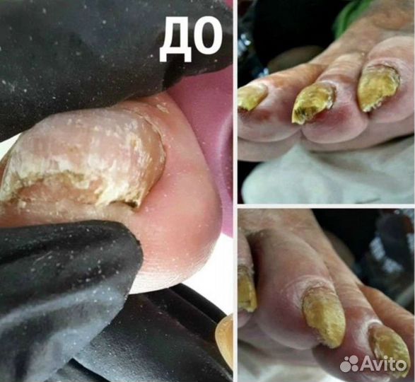 Услуги подолога