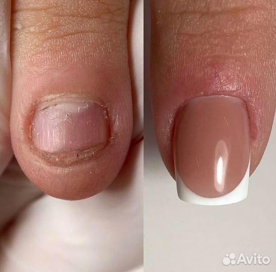 Маникюр, педикюр и наращивание ногтей