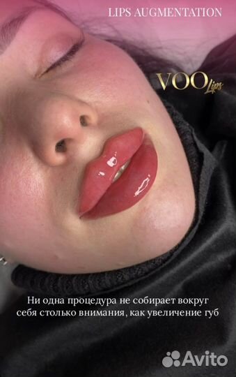 Косметолог, губы