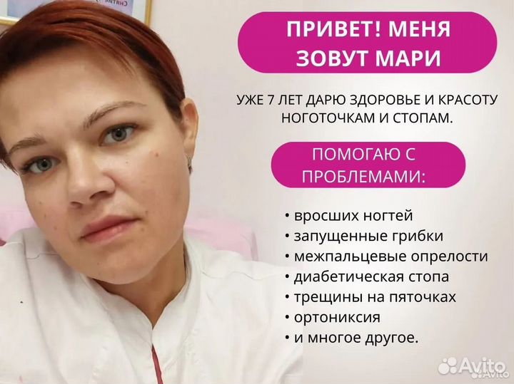 Лечение вросшего ногтя. Здоровый ноготок за 4 сеан