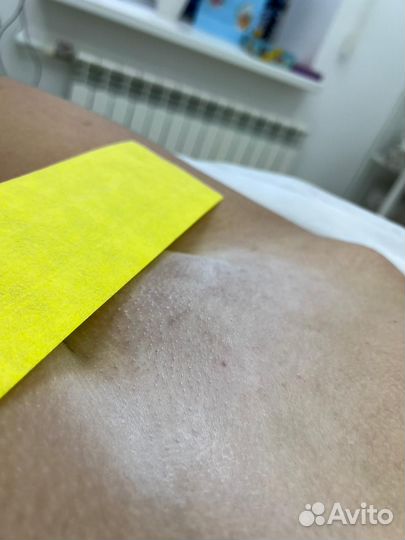Депиляция воском