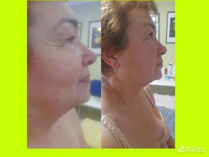 Массаж лица и тела Коррекция фигуры