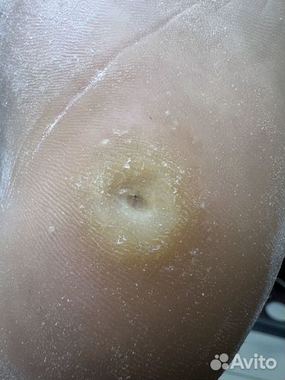 Подолог Бор