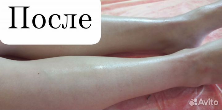 Шугаринг Ваксинг