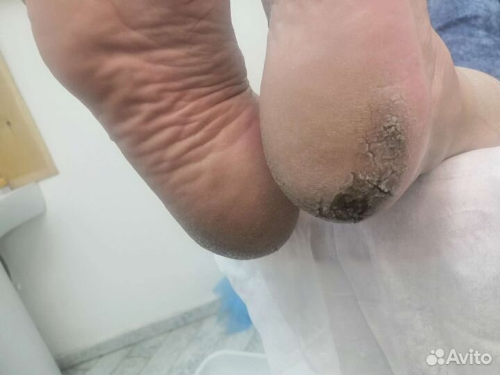 Педикюр для мужчин