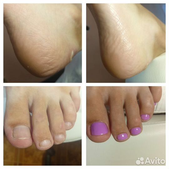 Смарт педикюр