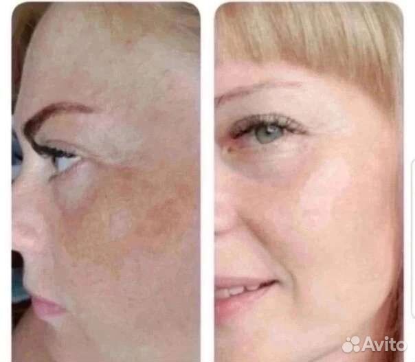 Сыворотка для лица корея