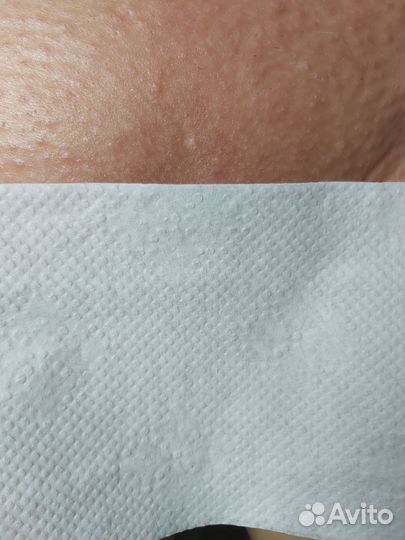 Спа-депиляция (сахар,воск), Кривко, Сосново