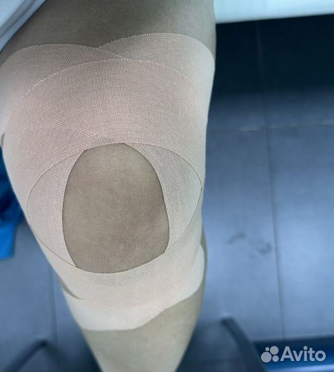 Тейпирование тела