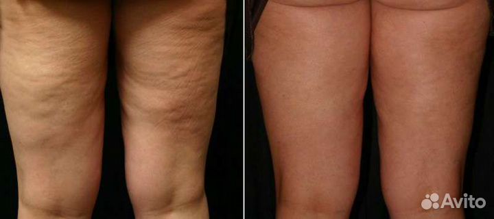 Массаж для мужчин и женщин