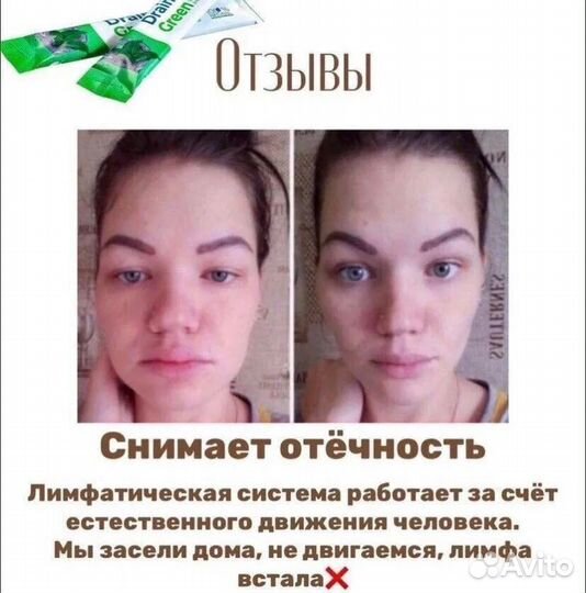 Драйнэффект
