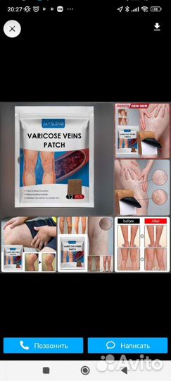 Пластыри от варикоза