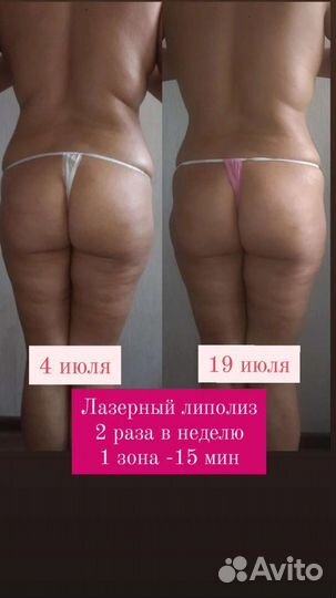 Коррекция фигуры