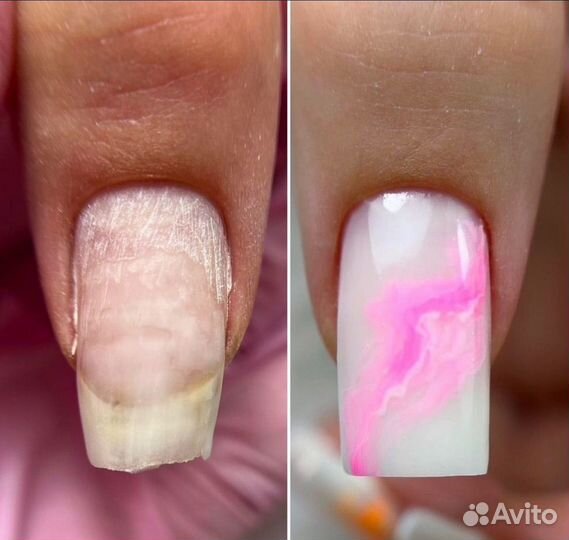 Курсы обучение маникюру, укрепление гелем