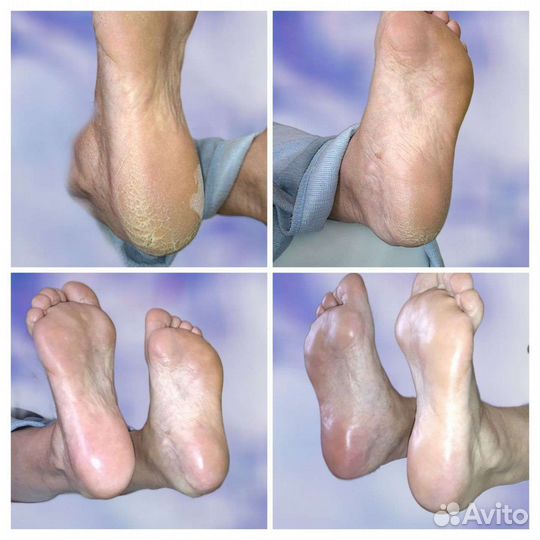 Смарт педикюр