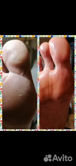 SMART педикюр