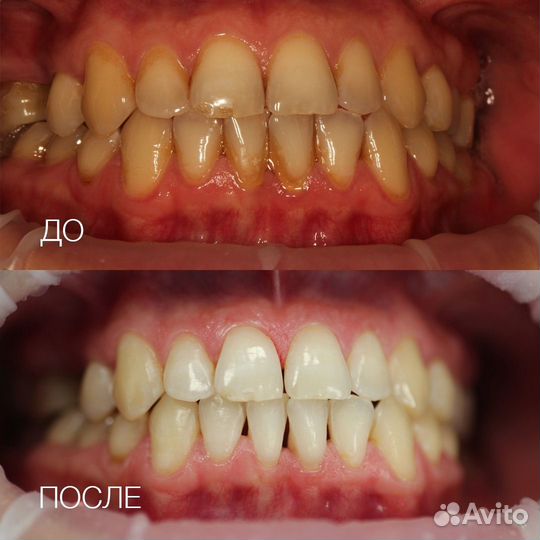 Сертификат на профессиональную гигиену полости рта