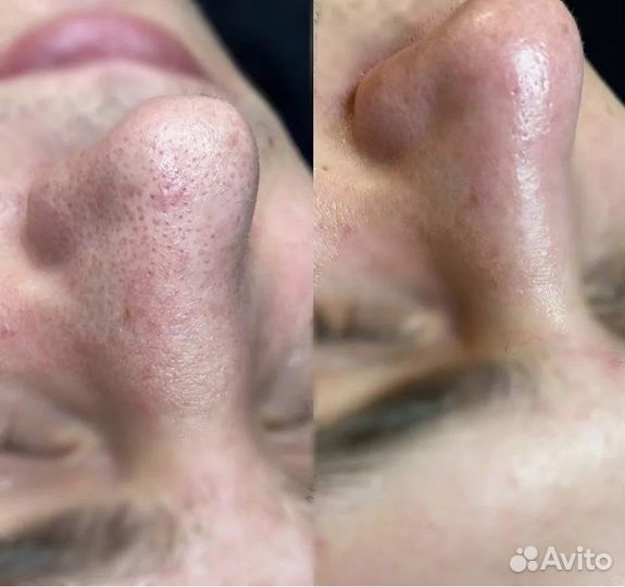 Классический массаж