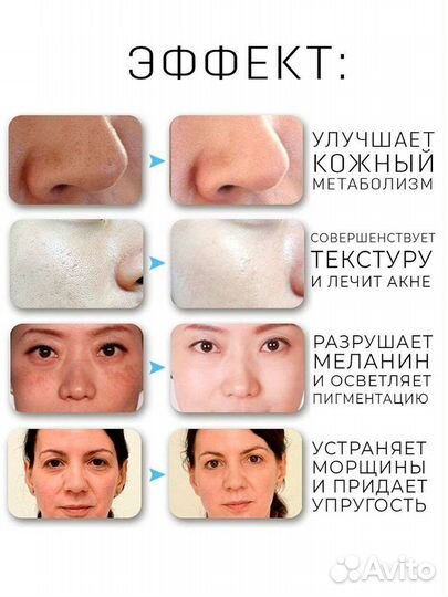 Новый Дарсонваль