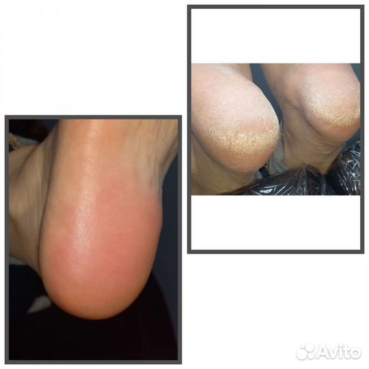 Педикюр Маникюр (жен, муж, дет) на Гончарова, 1