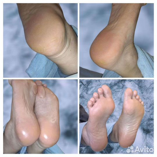 Смарт педикюр