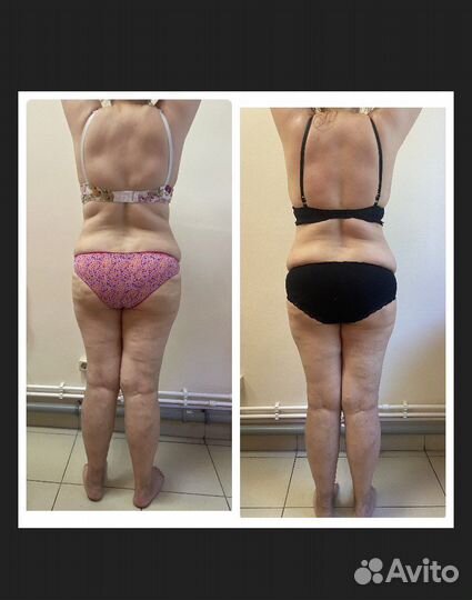 Массаж/ энергомассаж/лицо/тело