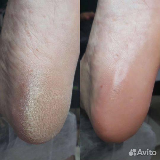 Смарт педикюр/маникюр Сочи Макаренко