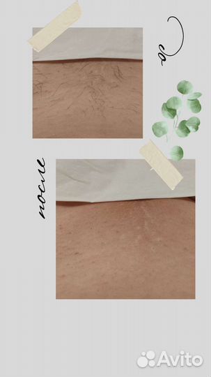 Депиляция воском: глубокое бикини