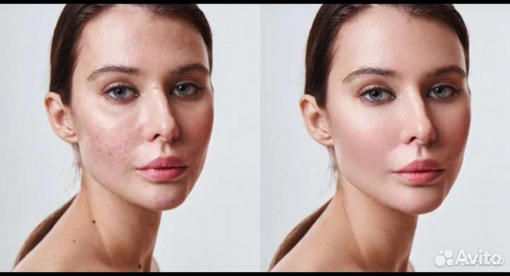 Плагины Retouch4me Photoshope