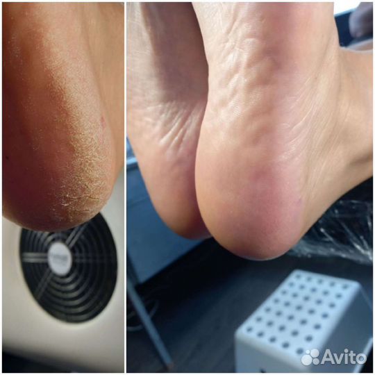 Педикюр Маникюр (жен, муж, дет) на Гончарова, 1