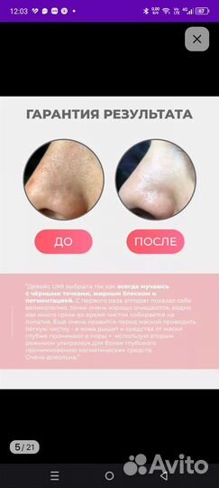 Ультразвуковой аппарат для чистки лица