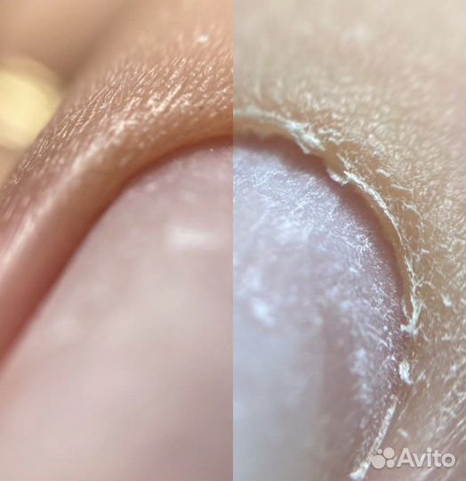 Маникюр, наращивание ногтей