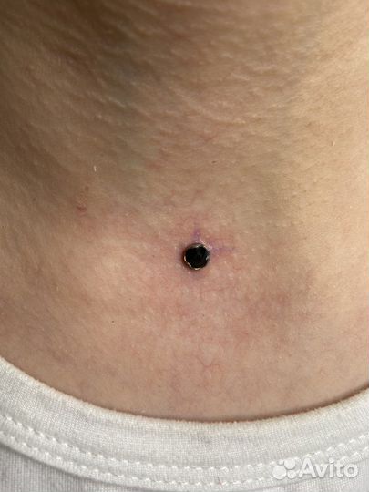 Модели на микродермалы