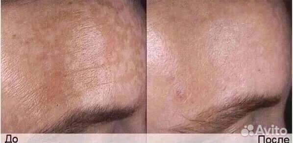 Сыворотка для лица корея