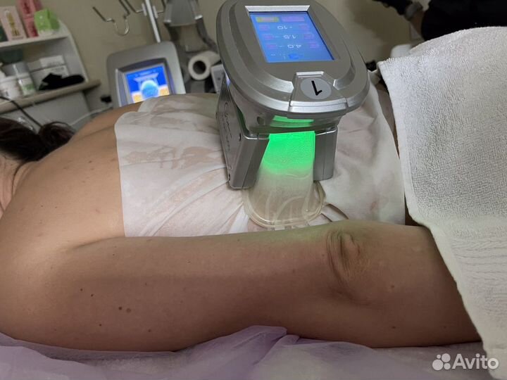 Криолиполиз (разрушение жира с помощью холода)