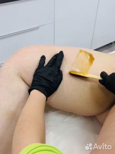 Скинс депиляция