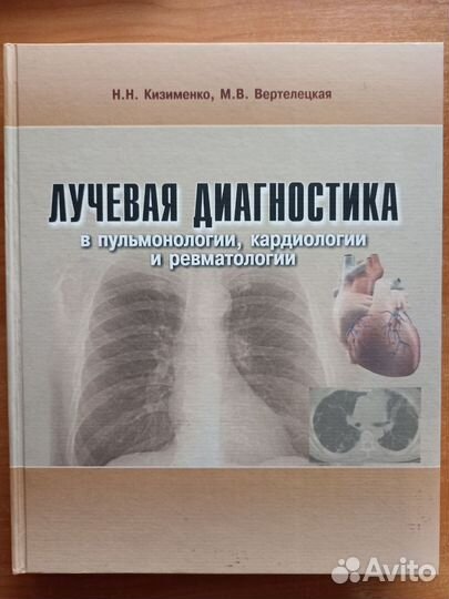 Книга по лучевой диагностике