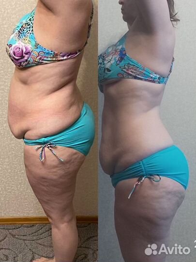 Обёртывание для похудения